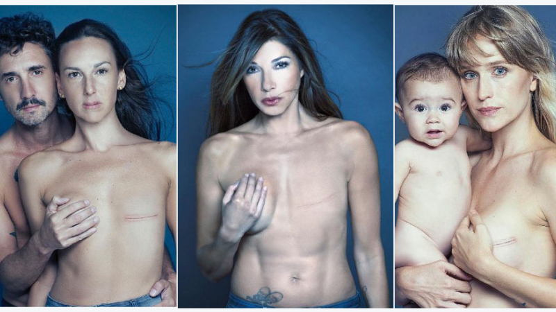Famosas realizaron una impactante campaña contra el cáncer de mama