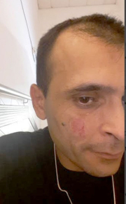 POLI-LESIONADO.jpg