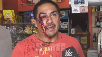 Dos heridos en violenta entradera en un comercio