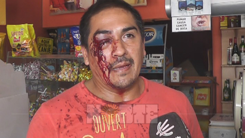 Dos heridos en violenta entradera en un comercio