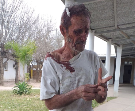 herido.jpg