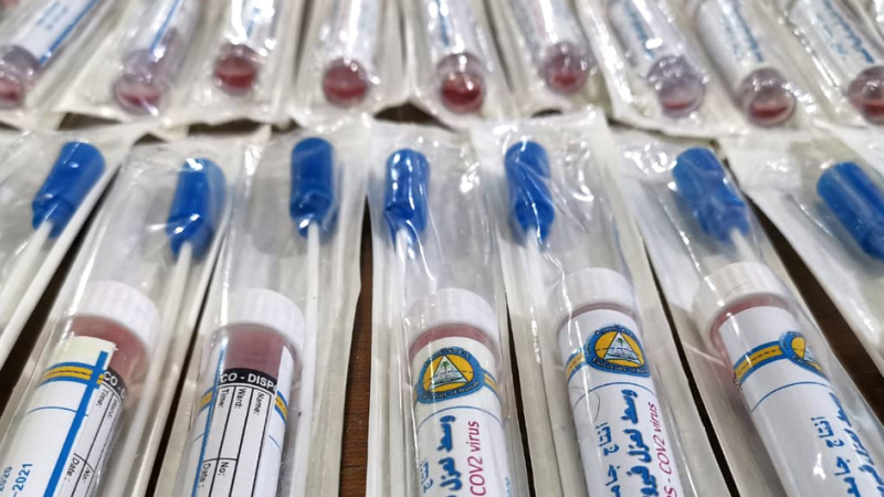 Coronavirus: Tres vacunas ya comienzan ensayos clínicos