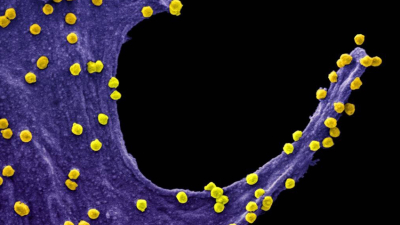 El Sars-CoV-2 y sus mecanismos de infección