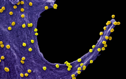 coronavirus.jpg