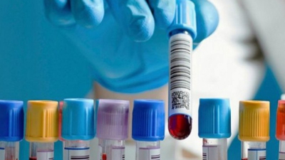 Bioquímicos: Los honorarios profesionales son de carácter alimentario