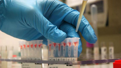 Anmat aprobó una nueva droga para tratamiento de pacientes con cáncer de pulmón