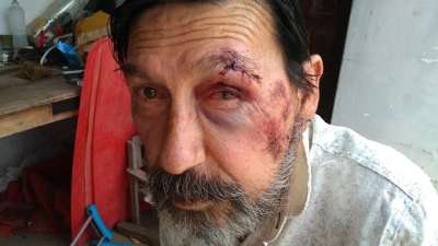 Asaltado en la vereda de su casa y por no tener más dinero lo golpearon