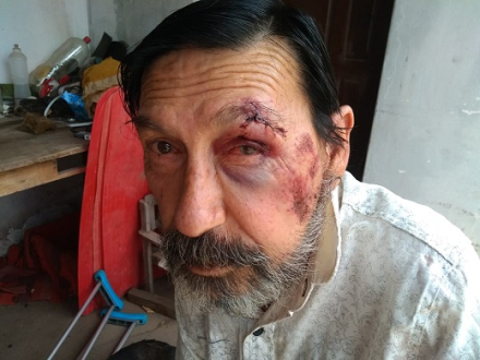 golpeado.jpg