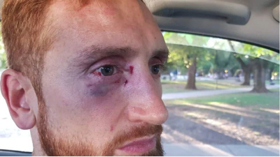 Básquet: hinchas de Peñarol atacaron a Alejandro Reinick, jugador de Quilmes