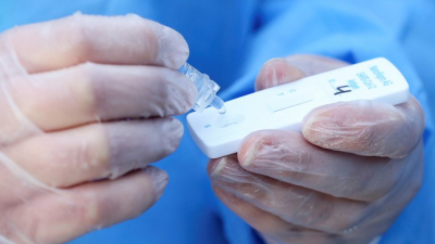 La Anmat aprobó un test rápido de coronavirus que ya se vende en farmacias