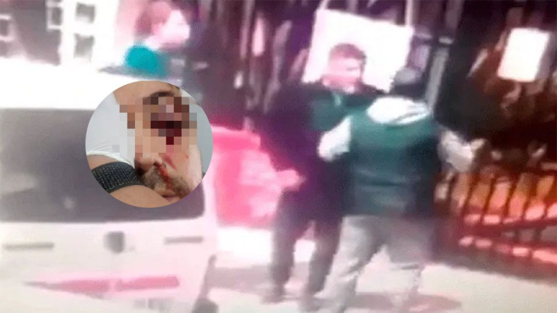 Dos padres se pelearon en la puerta de la escuela de sus hijos y uno de ellos perdió un ojo
