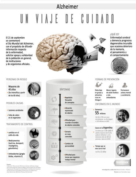 alzheimer-sm.jpg