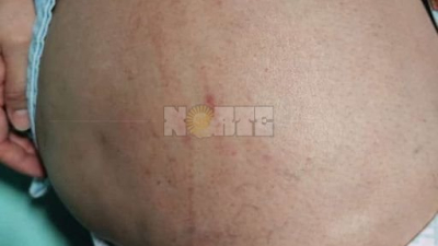 Resistencia: buscan al "abusador de la camisa blanca" en la zona sur