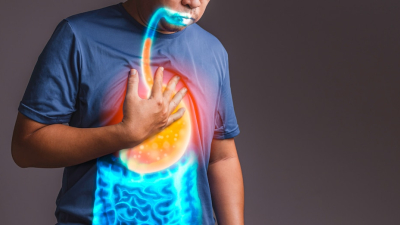 Qué es el reflujo y cuál es su impacto en la calidad de vida