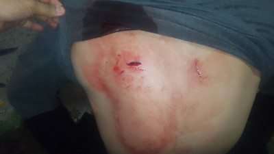 Detuvieron a dos mujeres trans por apuñalar a un hombre