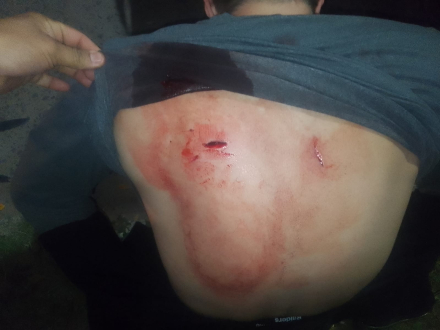 apuñalado Rcia 2.jfif