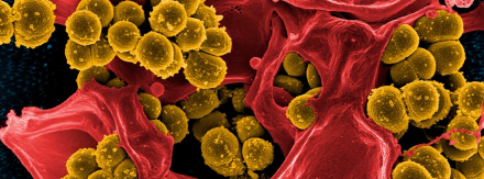 Superbacterias.jpg