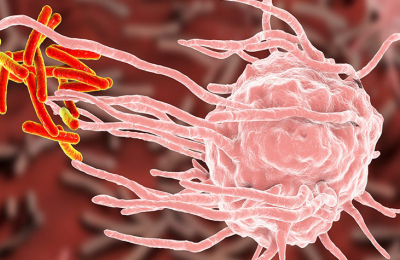 Oncología: ¿por qué unas células hacen metástasis y otras no?