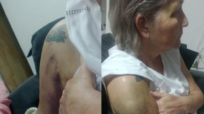 Tras ataque de motochorros, será operada la exdirectora del Hospital Pediátrico