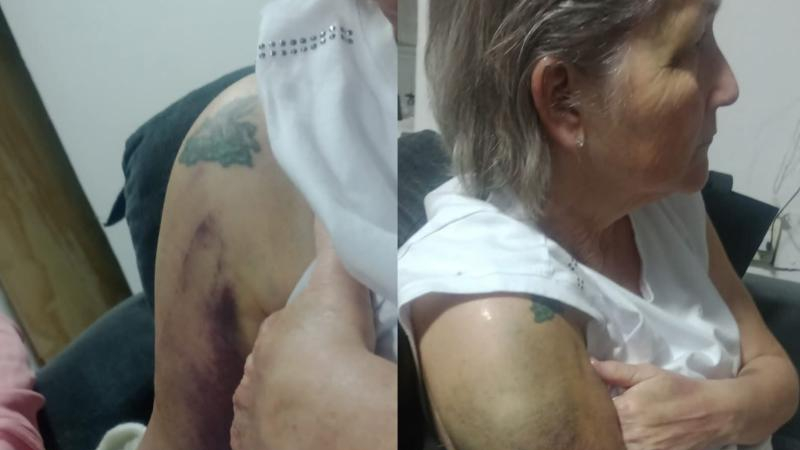 Tras ataque de motochorros, será operada la exdirectora del Hospital Pediátrico