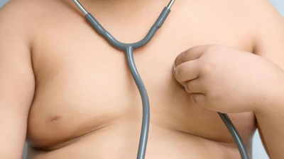 El déficit de vitamina D en niños con sobrepeso u obesidad