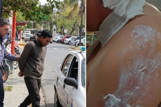 Quedará en libertad el acusado de quemar con agua hirviendo a su pareja
