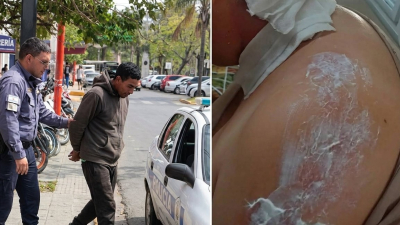Quedará en libertad el acusado de quemar con agua hirviendo a su pareja