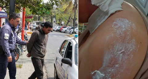 Quedará en libertad el acusado de quemar con agua hirviendo a su pareja