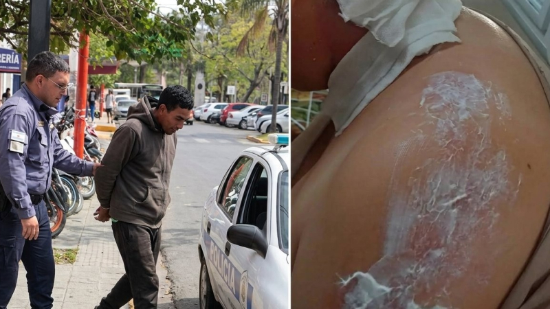 Quedará en libertad el acusado de quemar con agua hirviendo a su pareja