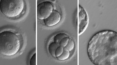 Tijeras moleculares para corregir genes, la medicina atrapada entre la esperanza y el debate ético