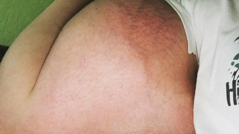 El “Popeye Ruso” se quitó aceite de sus bíceps para no morir