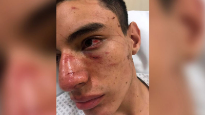 Golpiza a un rugbier: defendió a su amiga y fue atacado por 15 jóvenes
