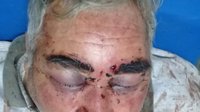 Corzuela: entraron a robar a una vivienda y atacaron brutalmente a un adulto mayor
