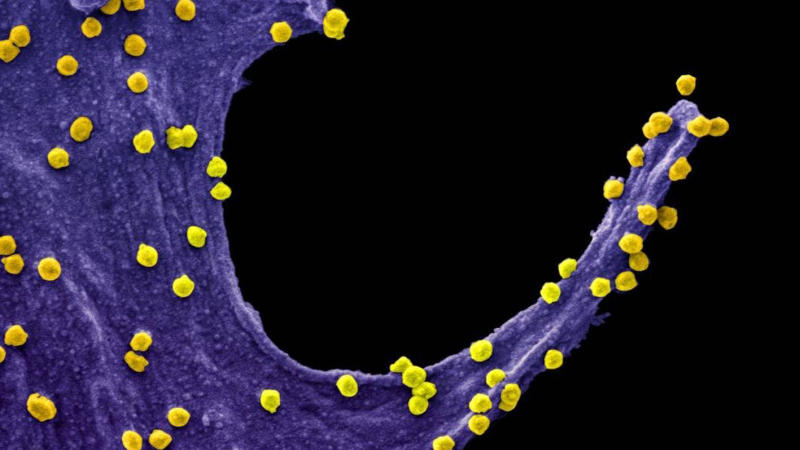 Cuatro cosas que sí se saben sobre el coronavirus, según la Sociedad Argentina de Inmunología