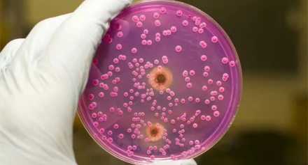 Candida Auris.jpg