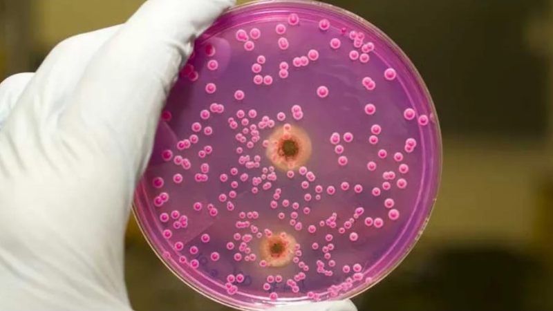 Nueva amenaza mundial: candida auris, la posible nueva pandemia