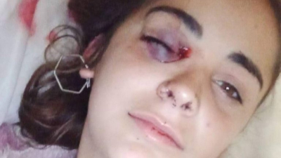 Incidentes en Rojas por el femicidio de Úrsula: el momento en que la policía baleó en la cara a una manifestante