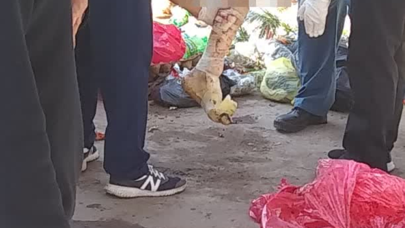Resistencia: hallaron una pierna en un contenedor de basura