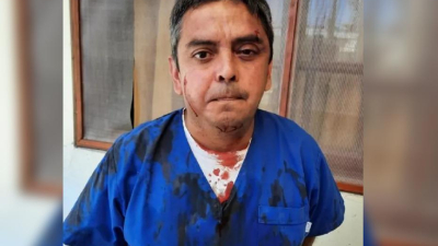 Se contagió covid y agarró a piñas al Secretario de Salud