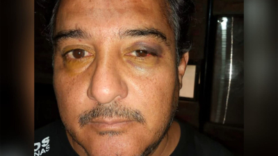 Grave agresión a empleado municipal de Los Frentones