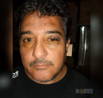 los frentones.jpg