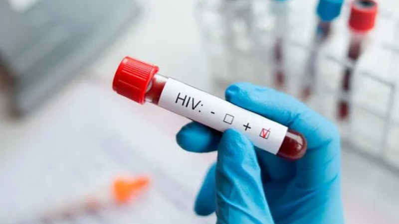 Científicos argentinos logran un importante descubrimiento sobre el VIH
