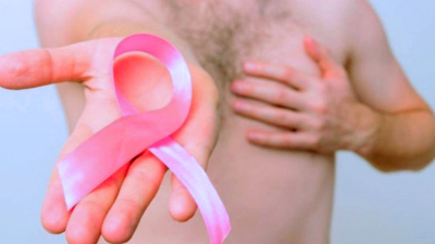 Aprobaron la indicación en hombres de una droga para el cáncer de mama