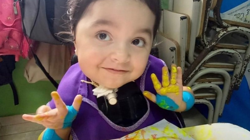 Emmita recibirá una terapia combinada que mejorará el funcionamiento de sus músculos
