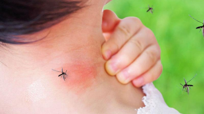 ¿Por qué los mosquitos pican más a algunas personas que a otras?