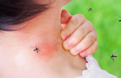 ¿Por qué los mosquitos pican más a algunas personas que a otras?