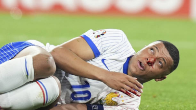 Mbappé se fracturó el tabique en el triunfo ante Austria