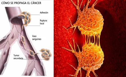 Metastasis2.jpg