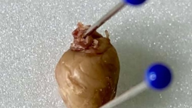 Analizan el impacto de las dietas ricas en grasa láctea sobre el músculo cardíaco