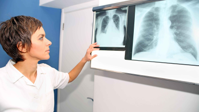 Una nueva opción terapéutica para los pacientes adultos con hipertensión arterial pulmonar